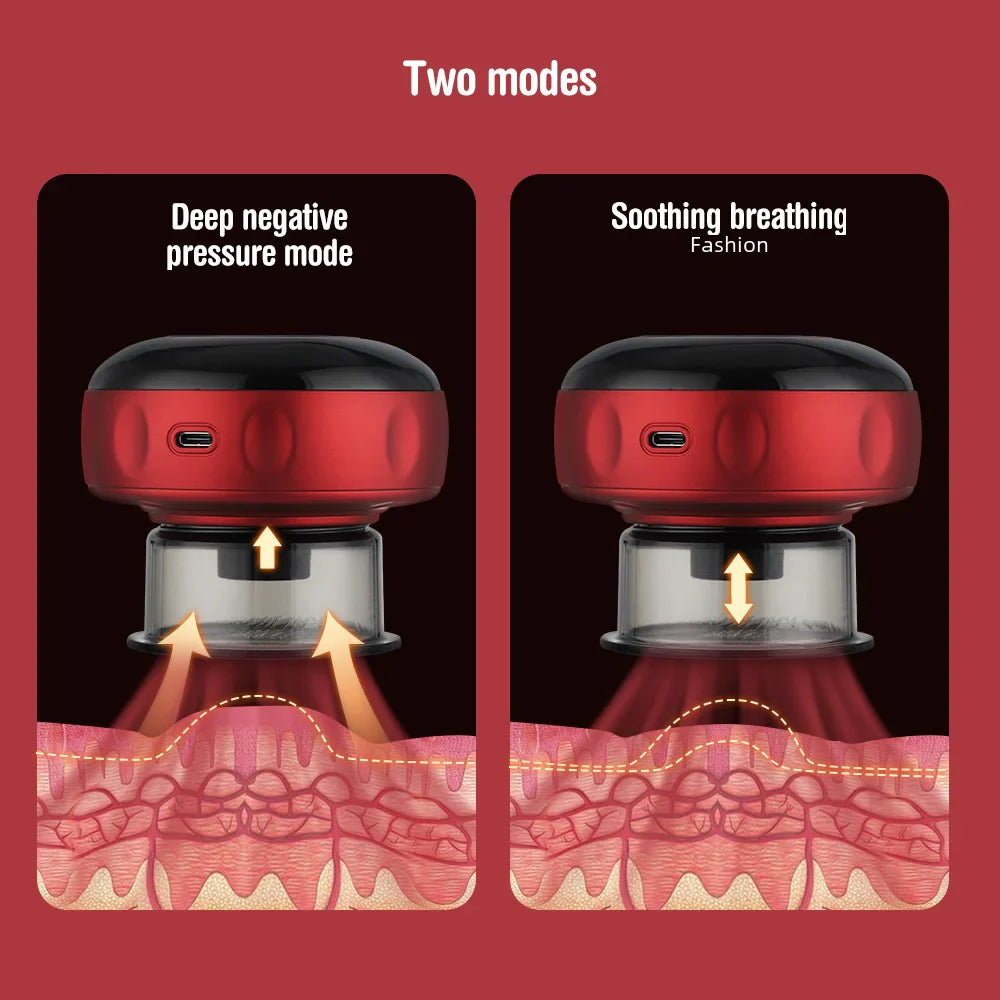 Open Sky General ™ Intelligent Cupping Massage Device With Heat